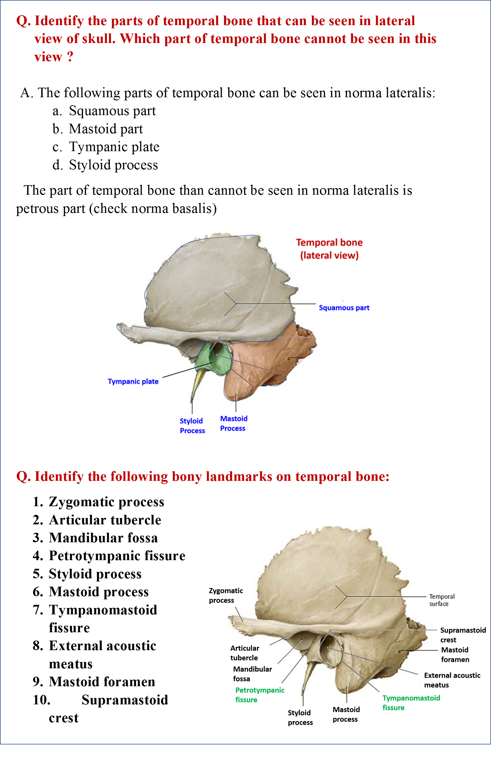 Parts of temporal bone and bony landmarks seen in norma lateralis