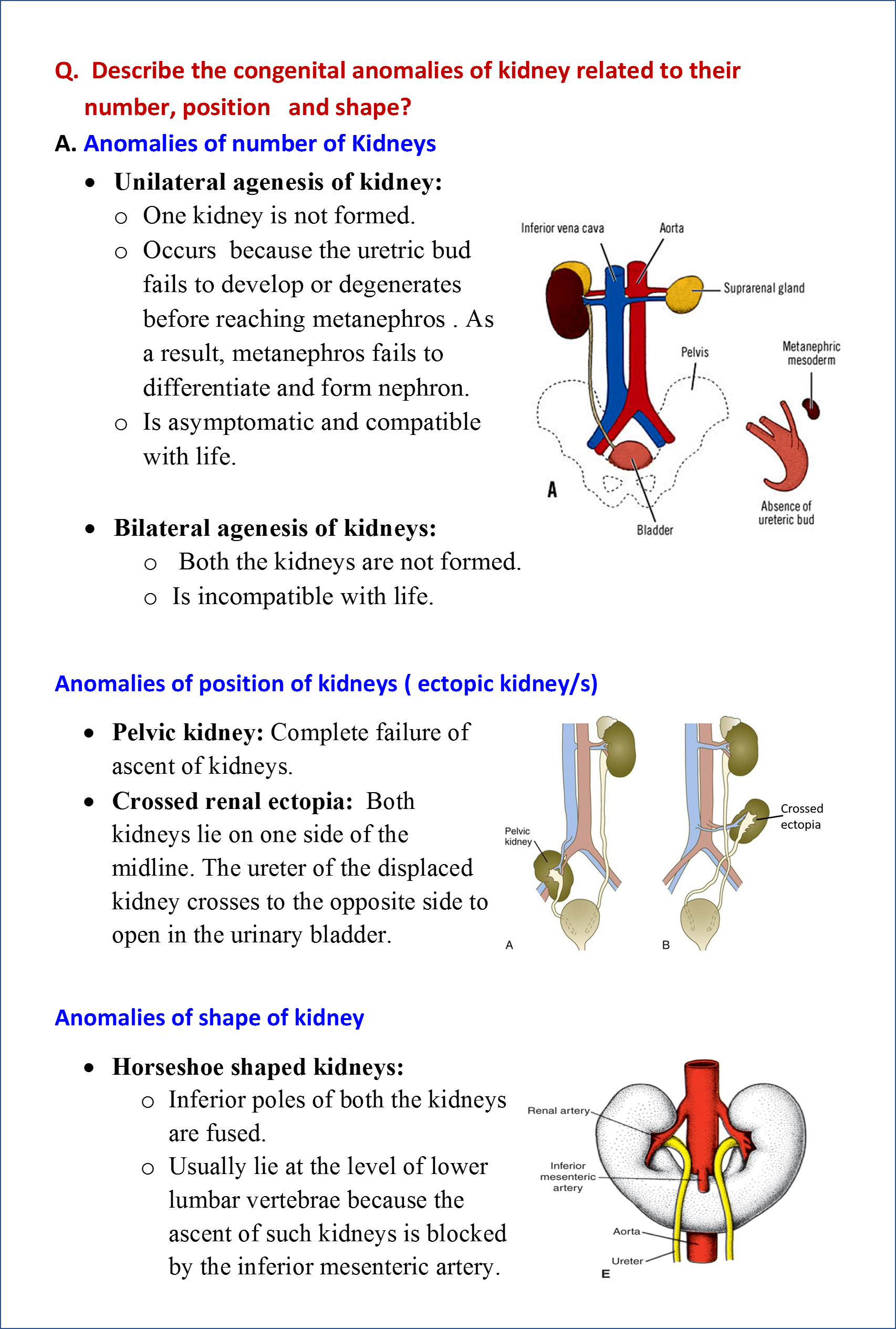 congenital anaomalies of kidney