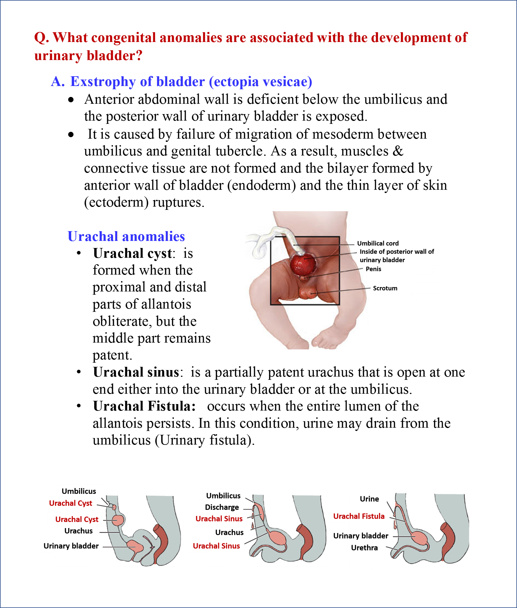 Development of Urinary Bladder and Urethra - Anatomy QA