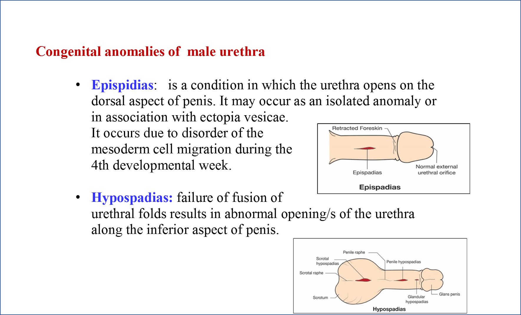 Congenital Anomalies of Male Urethra