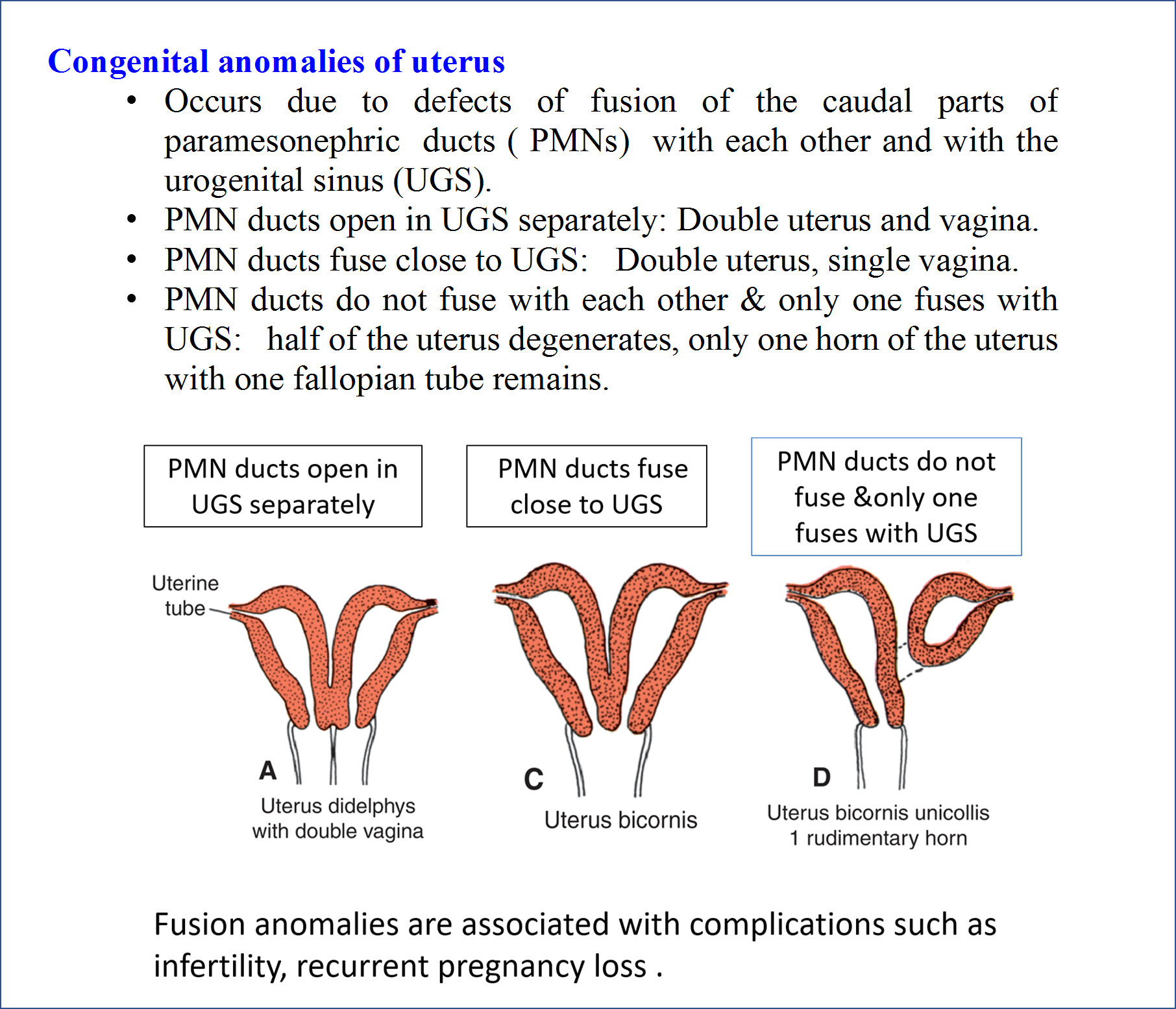 Congenital Anomalies of Uterus
