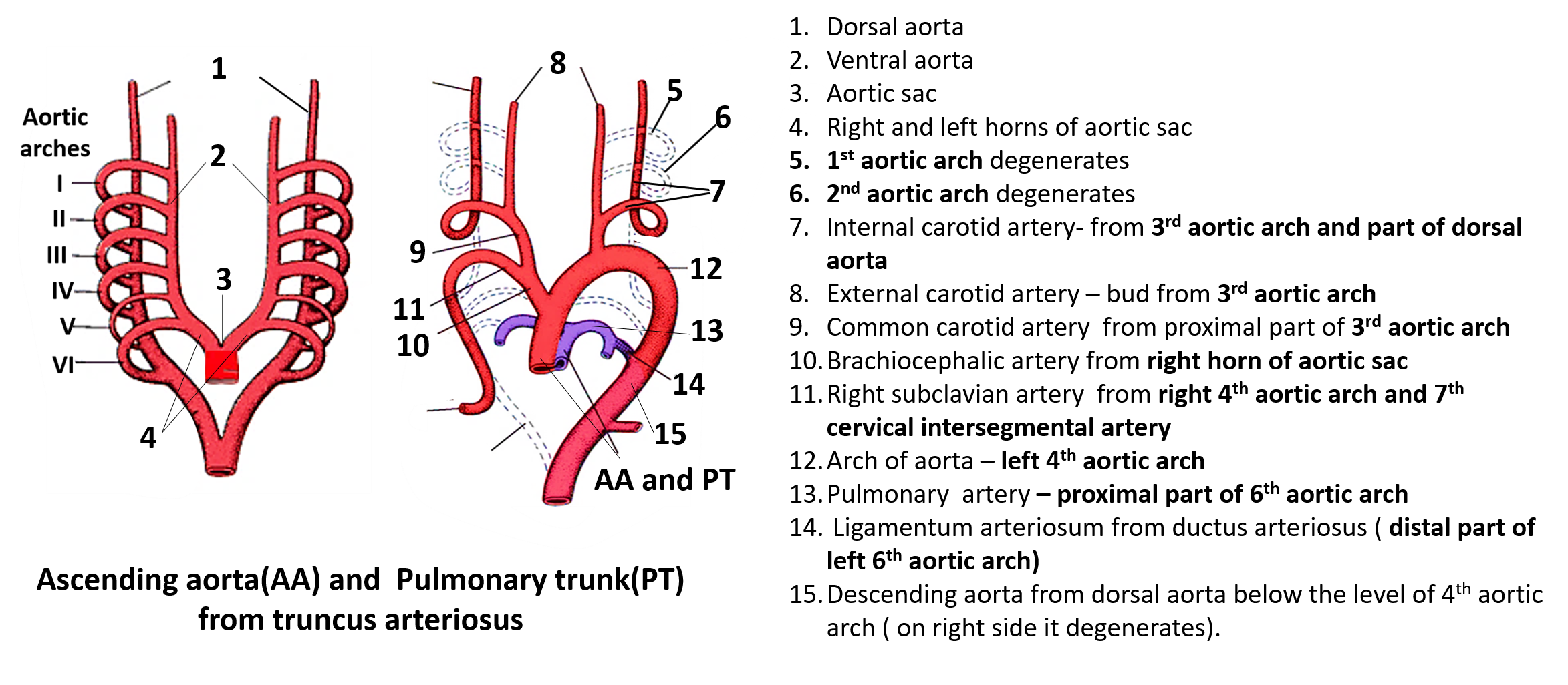 Right aortic arch with left ductus