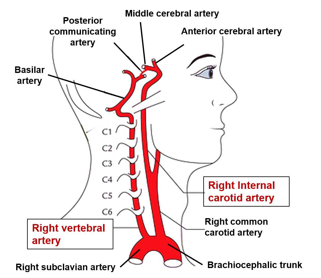 Posterior Spinal Artery